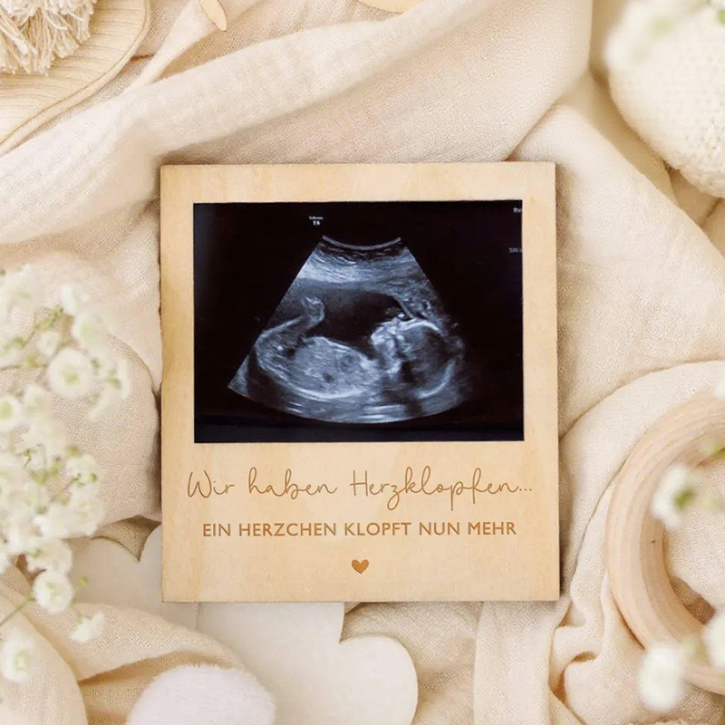 Ultrasound Pregnancy Announcem - đánh giá và giá Photography Prompt