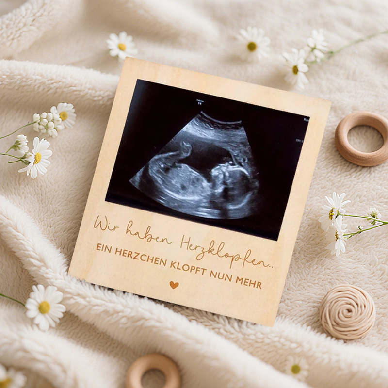 Ultrasound Pregnancy Announcem - đánh giá và giá Photography Prompt